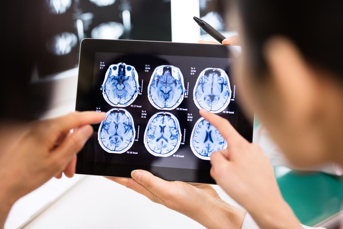 doctors-looking-at-brain-scans