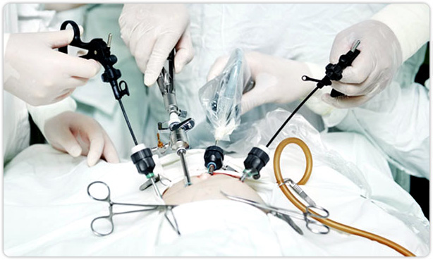 Minimally-Invasive-Surgery-Equipment