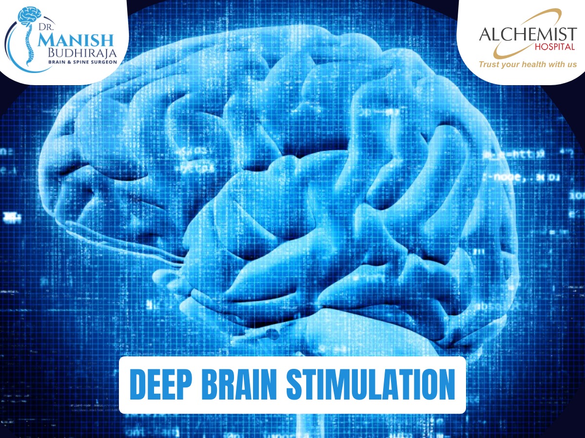 You are currently viewing Deep brain stimulation