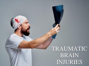 Read more about the article Traumatic Brain Injury
