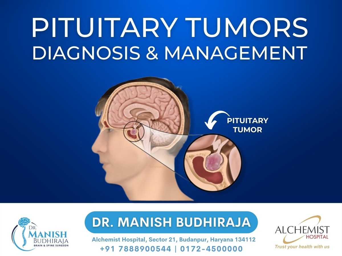 Read more about the article Understanding The Pituitary Tumors Symptoms & Management