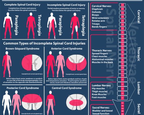 Types-of-Spinal-Cord-Injuries